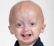 Progeria Research Foundation